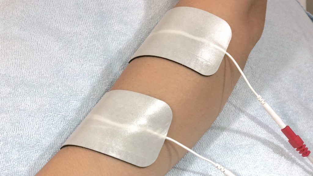 elektrik stimulasyonu