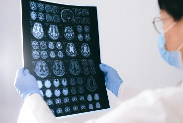 Beyin Tümörü Sonrası Fizik Tedavi ve Rehabilitasyon