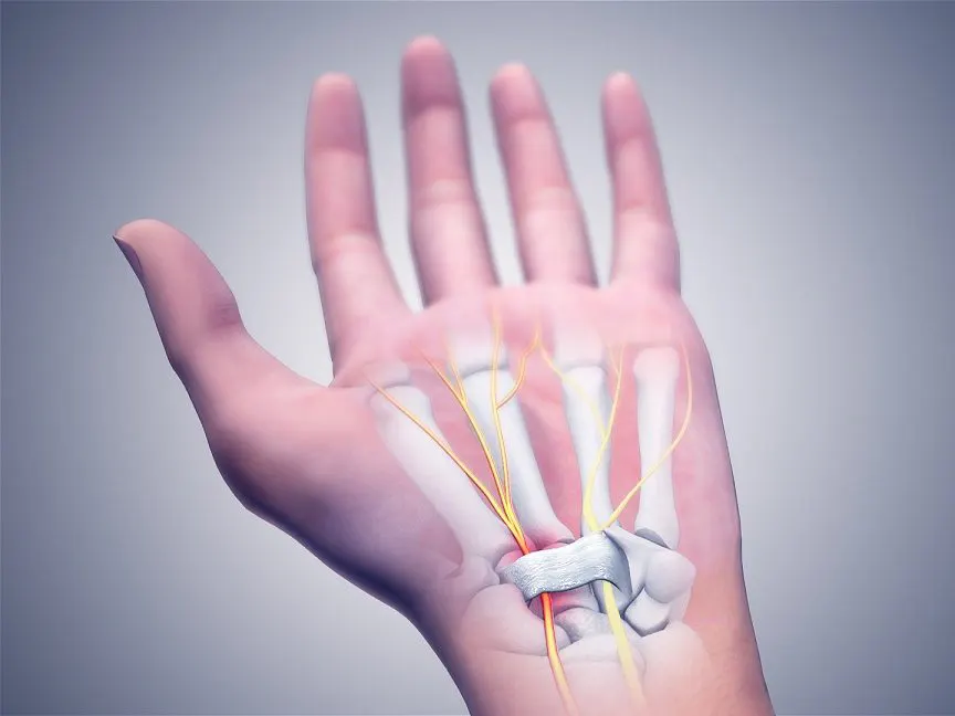 Sinir Sıkışması Nedir? Neden Olur? - Doktor Fizik