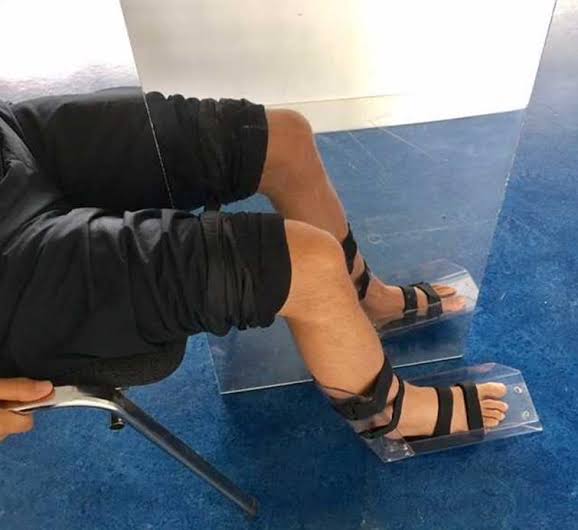 Bacak hareketlerine yönelik bu terapi uygulanabilir. Bu alandaki bilimsel çalışmaların sayısı ele kıyasla daha az olmakla beraber günden güne artmaktadır.