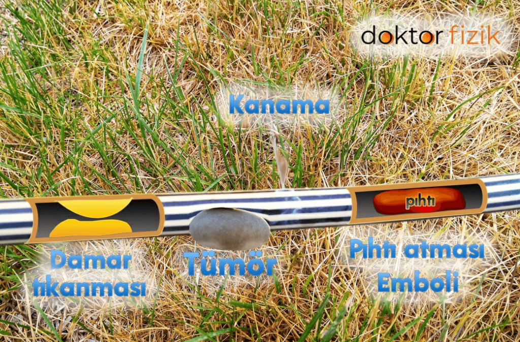 kalp ve felç sağlığı kontrol etiketi