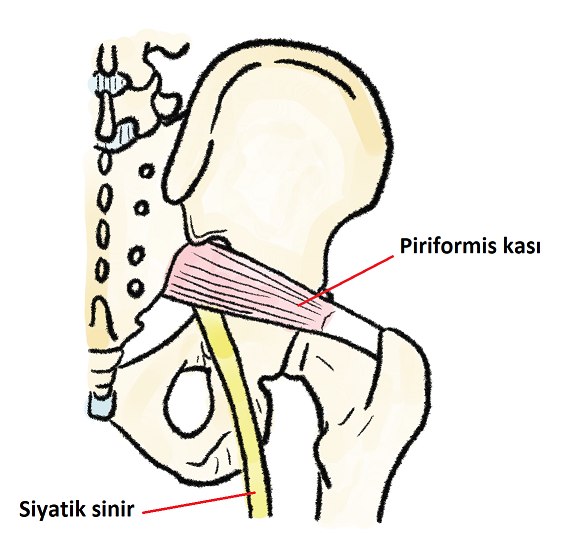 Bacak ağrısına sebep olabilecek siyatik sinir ve piriformis kası
