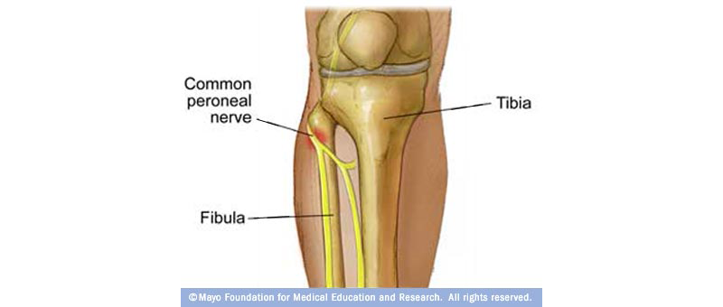 ortak peroneal sinir