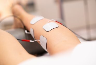 elektrik stimulasyonu nedir